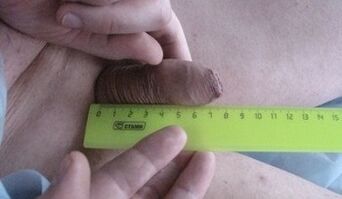 Peenise suuruse mõõtmine